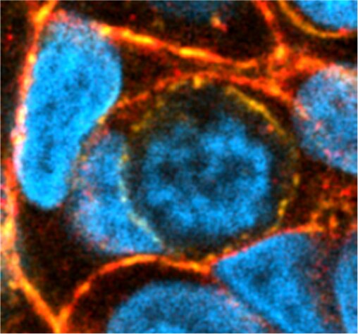 Entoza w komórkach linii MCF7 (luminalny rak piersi). Niebieski (DAPI) – jądra komórkowe, czerwony (falloidyna) – aktyna, zielony – plakoglobina. Zdjęcie wykonane przy pomocy mikroskopu konfokalnego Zeiss LSM800.